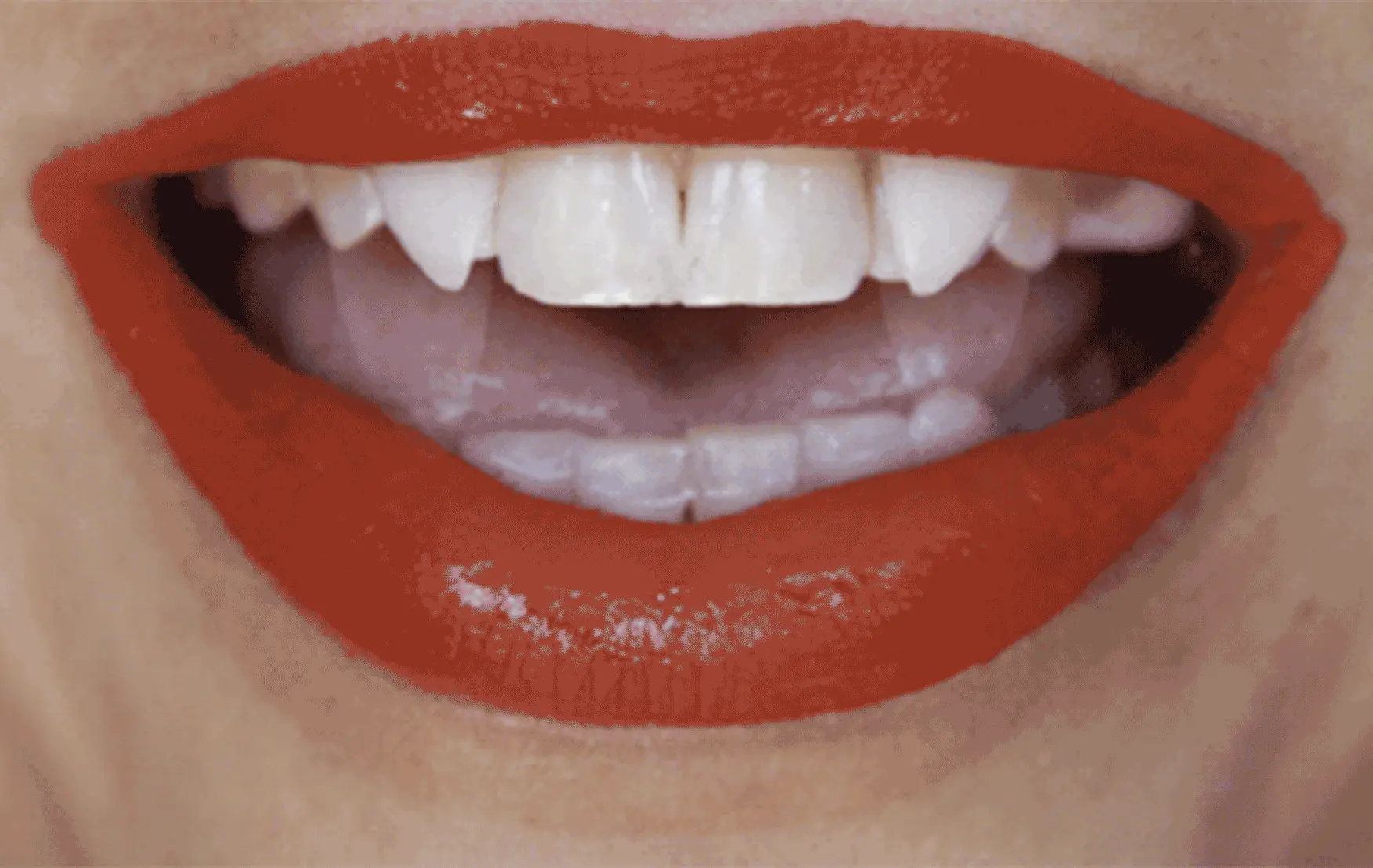 Default Down Retractable Fangs 3 Default Down Retractable Fangs